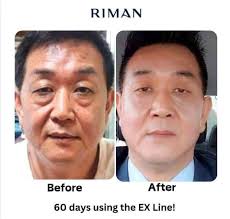 Dr. Bronner's tea tree soap features