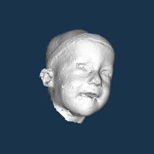 Shape-based Quantification of 3D Face Data for Craniofacial Research