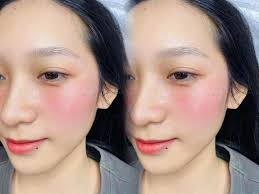 สะเดาไม่ทิ้งกัน