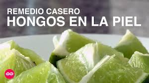 Después de eso, lávate los pies y. Como Quitar Hongos En La Piel Con Remedios Caseros Remedioscaseros Sin Recipe Youtube