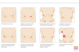 Tell us where we can send your free copy: This Is What My Breast Cancer Looks Like Woman S Facebook Photo Of Symptoms Goes Viral