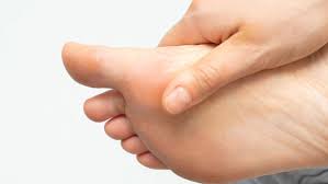 Sakit pada telapak kaki merupakan salah satu keluhan yang sangat mengganggu bagi siapa saja yang pernah megalami nya ,telapak kaki yang sakit sering sekali di alami ketika pagi hari.lalu apakah. 9 Penyebab Telapak Kaki Sakit Yang Harus Anda Ketahui