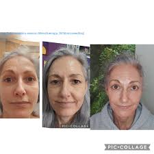 Beauty Aesthetics At The Rowans