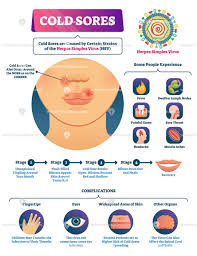 Pin On Health And Medicine Illustrated