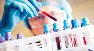 Canceladas duas provas de aferição marcadas para maio. Voce Sabe Qual A Importancia Dos Exames Laboratoriais Para Diagnostico De Doencas Silenciosas Laboratorio Sao Luis