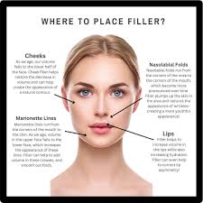 Kelsey Powers, RN (@aesthetics.by.kelseyp) • Instagram photos and videos