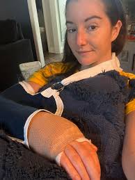 Recovery from tfcc injury