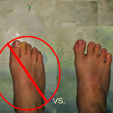 5 Tips For Improving Great Toe Mobility And Stability Foot Exercises Massage Work Therapy Ball
