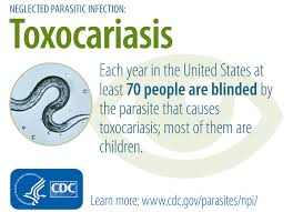 Individuals infected with roundworm parasites may show: Cdc Toxocariasis General Information