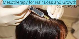 Many people think that hair loss only affects men. Mesotherapy For Hair Loss And Growth How It Works Paperblog