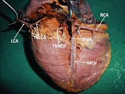 Because the heart points to the left, about 2/3 of the heart's mass is found on the left side of the body and the other 1/3 is on the right. Diaphragmatic Surface Of The Heart Showing The Terminal Parts Of The Download Scientific Diagram