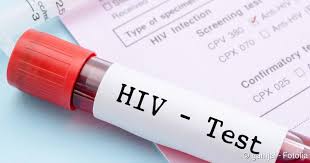 Preise & kosten des tests. Hiv Test Netdoktor
