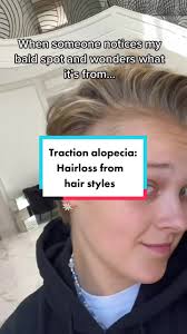 #stitch with @JoJo Siwa #tractionalopecia #hairloss #dermguru #dermtok  #hairtok #carryingyourlovewithme #hairlosstiktok