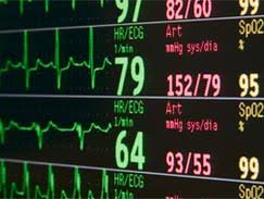 Un tatouage des battements du coeur dans le dos. Palpitations Cardiaques Quand Faut Il S En Inquieter