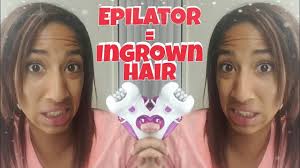 When you shave, the razor exfoliates your skin for you, so ingrown hairs are rare with saving. Say No To The Epilator Ingrown Hair Vlog Update Youtube