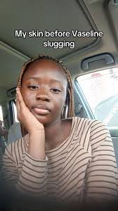 Face Slugging Before and After