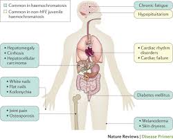 haemochromatosis nature reviews disease primers