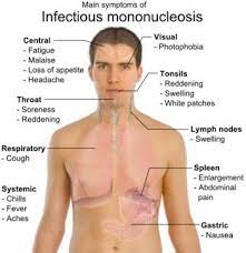 Mononucleosis: Symptoms, Diagnosis, And Treatment Options | Fastmed Urgent  Care