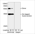 Cardiac-Myocyte-Specific Excision of the Vinculin Gene Disrupts