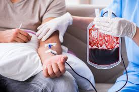 Image result for Plasma Transfusion