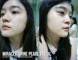 Xiao Vee: Indonesian Beauty Blogger: Miracle Aesthetic Clinic: Pearl Shine  Facial Treatment [review]