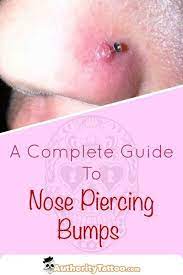 Nose Piercing Bumps Causes Treatments Guide Piercing Bump Nose Piercing Bump Nose Piercing Stud