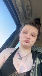 Overcoming addiction and recovering from injuries