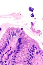 Ids offer a full range of prepared microscope slides please click here. Sarcina Genus Wikipedia