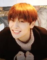 He Got His Braces Off Omg Now He Is Even Cuter We Love Our Jeongin Straykids Jeongin I N Vlive Braces Off Cool Kids I Love My Son