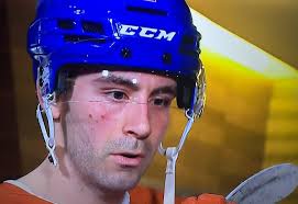 Edmonton Oilers (Parody) Interviews