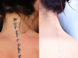 Another brit attending the breast cancer research foundation bash. Victoria Beckham Is Removing Her Tattoos