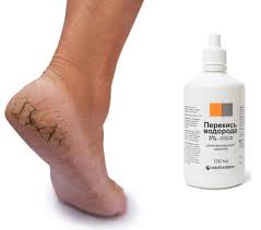 как сделать мазь от грибка ногтей из яйца и уксуса Sign In Tovary Dlya Zdorovya Produkty Dlya Zdorovya Spa Procedury