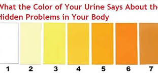 Image result for urine colour