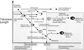 Prostate cancer is one of the most common types of cancer diagnosed in men. Telomerase Activity Modulation In The Prevention Of Prostate Cancer Urology