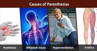 Image result for Paresthesia