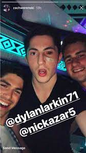 The columbus blue jackets (often simply referred to as the jackets or by the initialism cbj) are a professional ice hockey team based in columbus, ohio.they compete in the national hockey league (nhl) as a member of the metropolitan division in the eastern conference. Confirmed Blue Jackets Rookie Zach Werenski S Injured Eye Is Already Looking Better 1st Ohio Battery