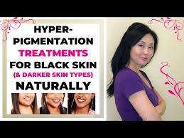 Dark spots, patchy skin, scarring. Hyperpigmentation Treatments For Black Skin