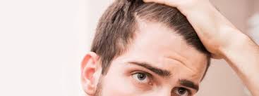 Facial hair needs to be treated in proper time so that it does not grow quickly and leave you red in the face. How Do I Tell If My Hairline Is Receding Hair Transplant Dubai