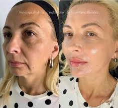 Reviews of Safi Miran Rejuvenation Center Denver