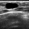 When the doctor knows this, they can choose the best course of treatment and maybe even predict your chances of recovery. Https Encrypted Tbn0 Gstatic Com Images Q Tbn And9gcrwi4aos9dfdm3ptmbyc04srmj1yrs78jqzyafmuxpgbvai2fhh Usqp Cau