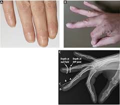 Image result for Digital Clubbing