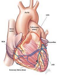 Check spelling or type a new query. Coronary Artery Disease Causes Symptoms Diagnosis Treatments