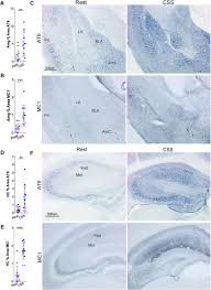 Chronic Sleep Disruption Advances the Temporal Progression of Tauopathy in  P301S Mutant Mice