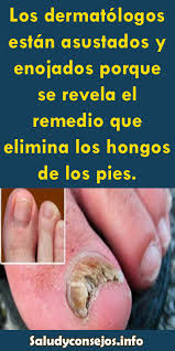 Hongos En Las Uñas De Las Manos Como Eliminarlos Gracias Por Visitar Nuestra Pagina Eliminar Hongos De Las Unas Remedio Para Hongos Hongos En Las Unas