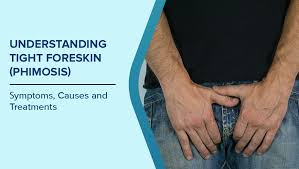 Image result for Phimosis