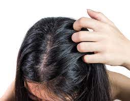 L'eccessiva produzione di sebo è la causa che rende la cute grassa e i capelli unti, oleosi e appiccicosi. Capelli Grassi Cosa Posso Fare Abbiamo I Migliori Consigli 2021