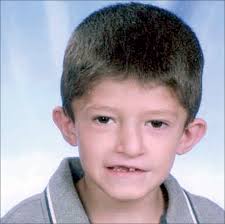 Velocardiofacial Syndrome Digeorge Syndrome The Chromosome 22q11 2 Deletion Syndromes The Lancet
