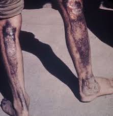 Health effects from the chernobyl disaster remain unclear, apart from the initial 30 people the soviet government confirmed killed from the explosions and acute radiation exposure. 35 Nuclear Radiation Ideas Nuclear Radiation Radiation Nuclear