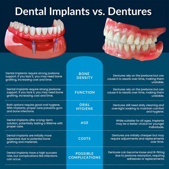 Comparing the structure, bone impact, and functionality of dental implants vs traditional dentures., AI generated