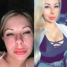 Today I am 60 days ✨SOBER✨ Hi I've been nervous to send this. I made a  choice to make sure I am around longer for my kids, some days are still a